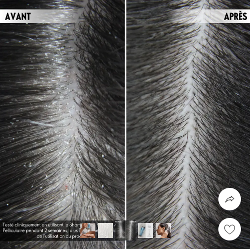 Shampoing Anti Pelliculaire Purifiant DUOLOGI